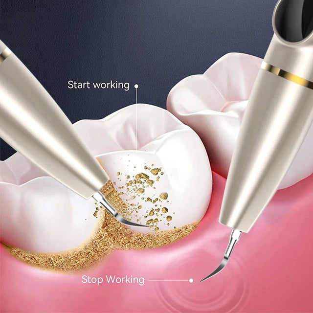 ClearSmile™ Ultrasonic Dental Scaler with Phone Connectivity